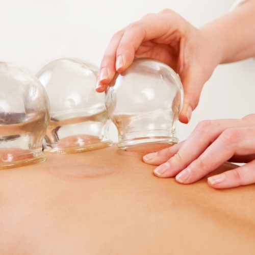 physical-therapy-clinic-cupping-active-spine-&-sport-therapy-chandler-az