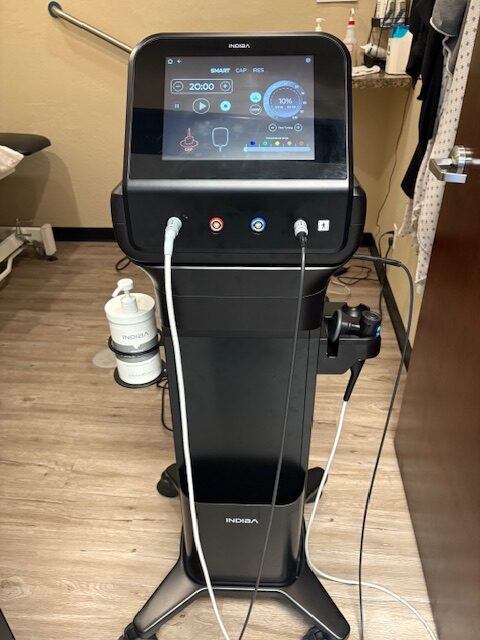 TECAR Therapy